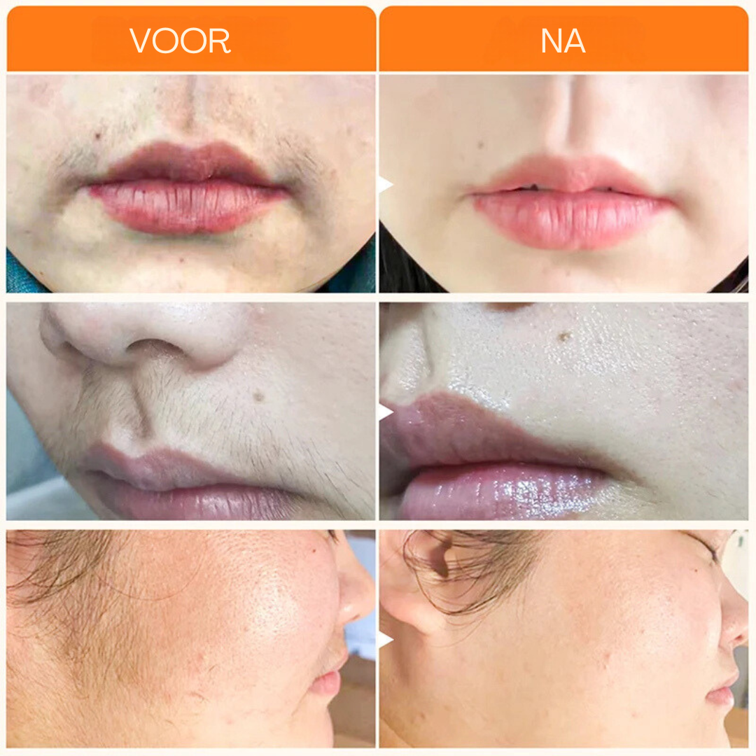 Hairvanish – innovatieve ontharingsoplossing voor gladde huid zonder irritatie, geschikt voor lichaam en gezicht.