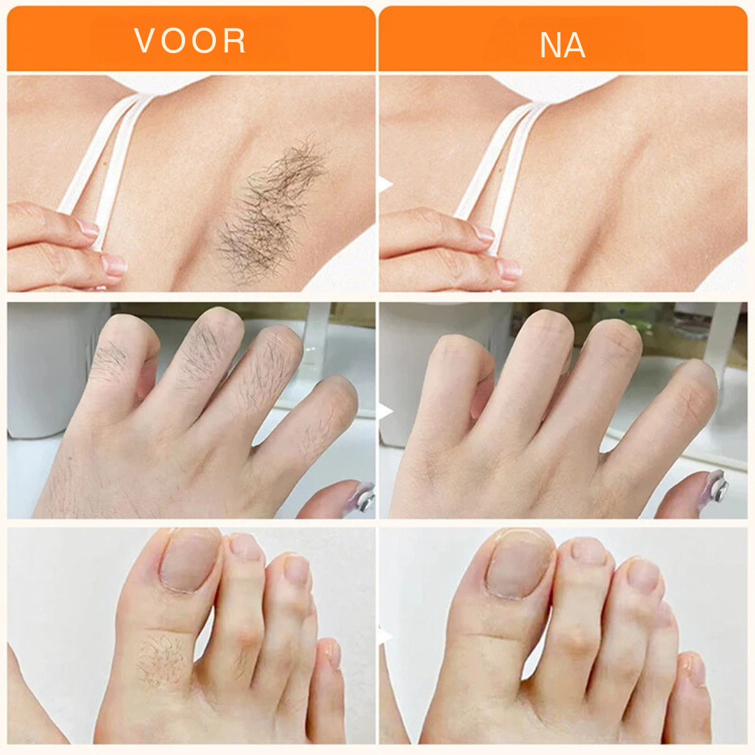 Hairvanish – innovatieve ontharingsoplossing voor gladde huid zonder irritatie, geschikt voor lichaam en gezicht.