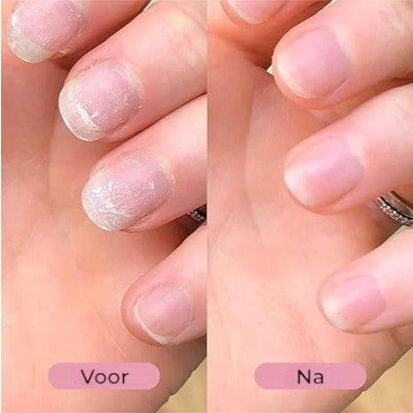 NagelGroei Pen met Stamcellen – herstel en versterk je nagels met deze innovatieve pen voor gezondere en sterkere nagels.