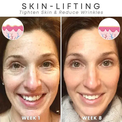 Stralend Jong collageen & retinol anti-aging crème – verbetert de huidtextuur en vermindert fijne lijntjes voor een jeugdige, stralende huid. Ideaal voor dagelijkse verzorging.