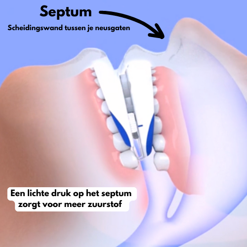 Snurk Stopper – Transparante anti-snurk neusclip in opbergdoosje, ontworpen voor comfortabel gebruik tijdens de nacht om snurken te verminderen.